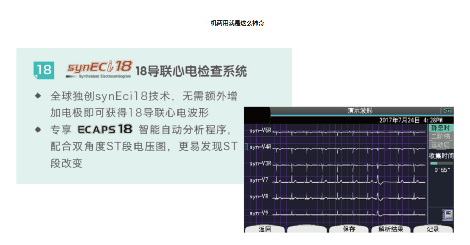 原裝進口ECG-2360十二道心電圖機3.png