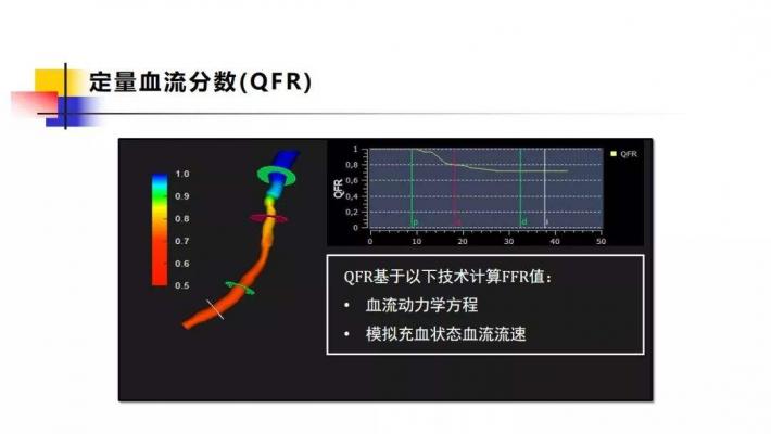 定量血流分?jǐn)?shù)測(cè)量軟件AngioPlus Core