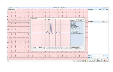 心電信息管理軟件pec-1
