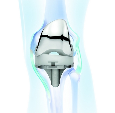強生全膝關節(jié)系統(tǒng)