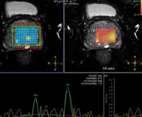前列腺mri醫(yī)學(xué)影像存儲傳輸與處理軟件
