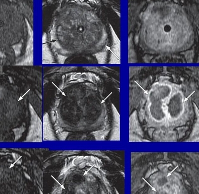 前列腺mri圖像分析處理系統(tǒng)