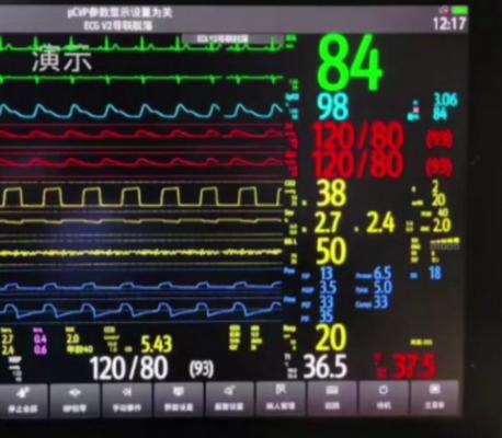 心臟遠程移動監(jiān)護系統(tǒng)